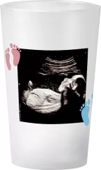 gobelet Baby Shower Baleine Photo