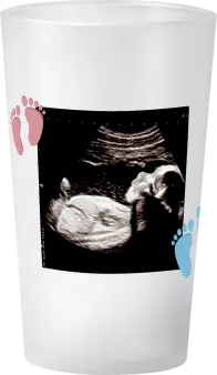 gobelet Baby Shower Baleine Photo